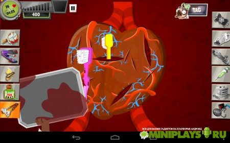 Amateur Surgeon 3