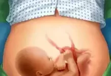 Operate Now: Hospital